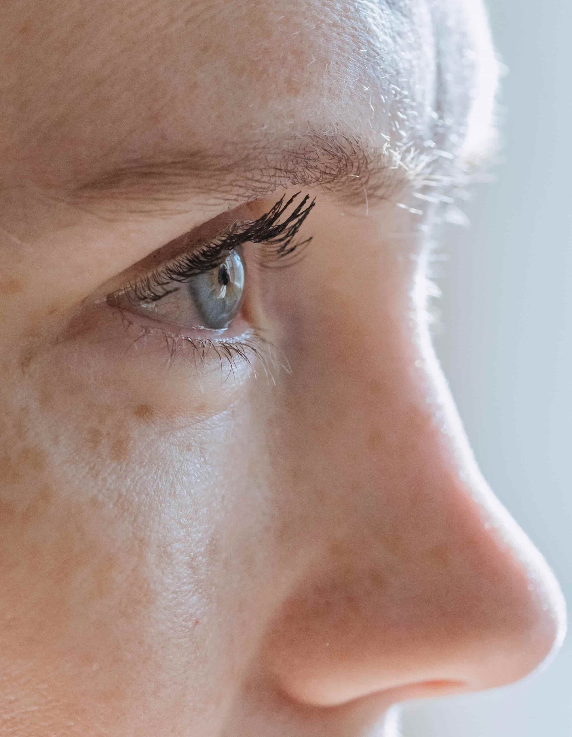 Dr. Ian MacArthur Board Certified Plastic Surgeon in Ottawa eyelid surgery