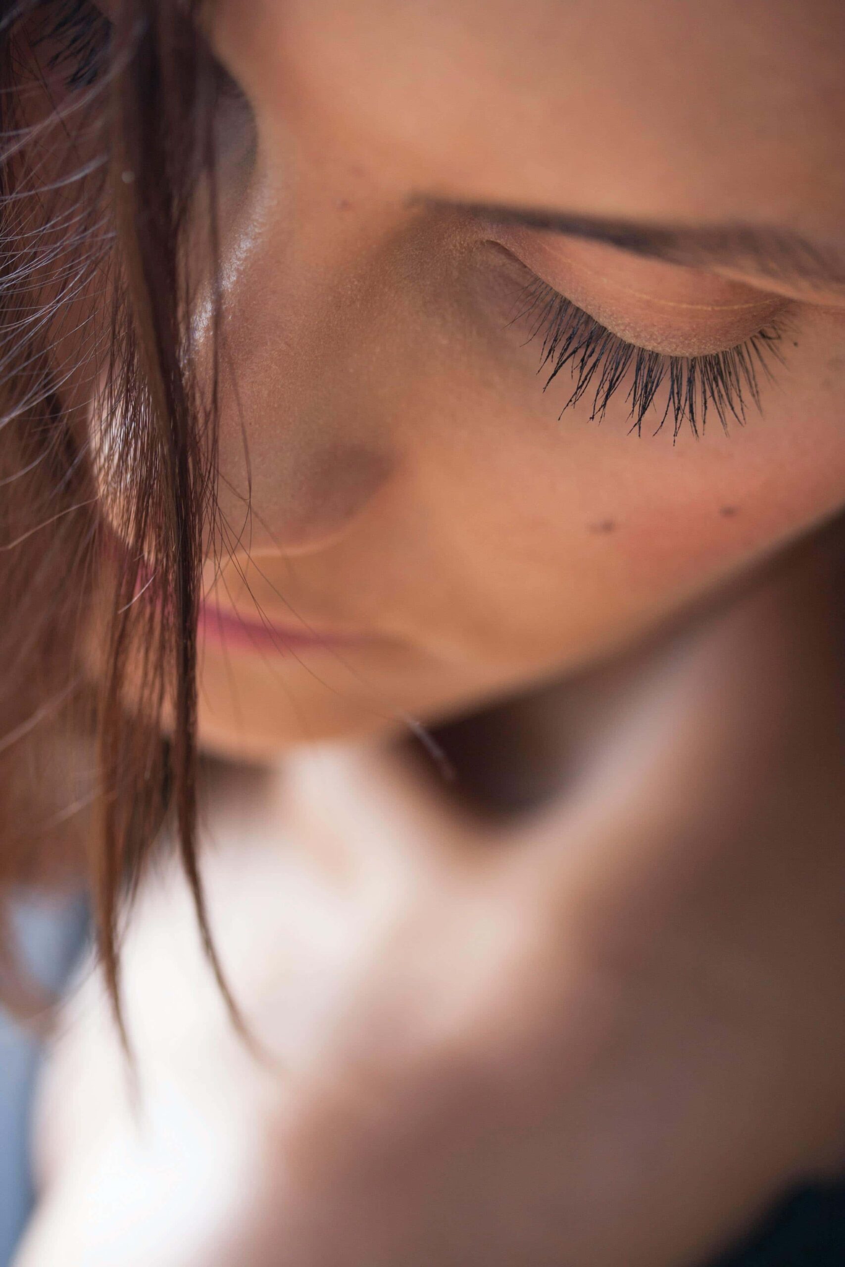 Dr. Ian MacArthur Board Certified Plastic Surgeon in Ottawa photofacial